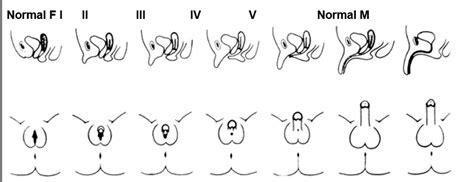 prader scale chart.